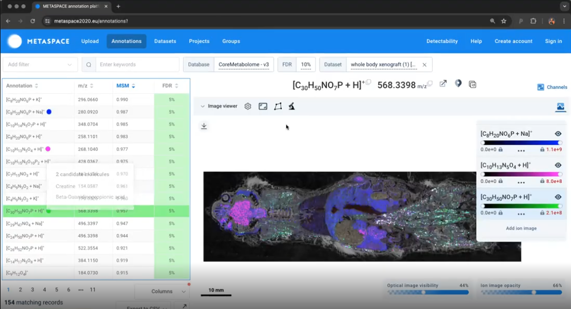 Metabolomics Interface 1